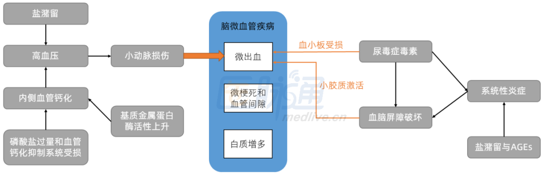 Nature子刊：專家解讀ARIC研究，揭示CKD患者認(rèn)知下降的秘密