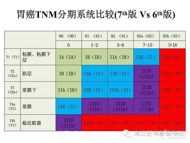 【影像筆記】胃癌CT的分期