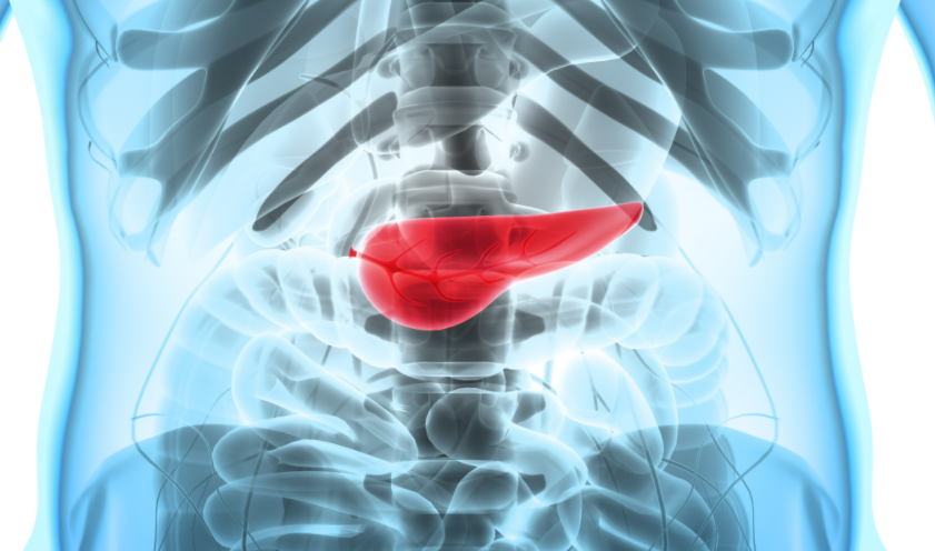 抓住“胰腺生機(jī)”！多項(xiàng)創(chuàng)新療法為晚期胰腺癌患者帶來生存希望