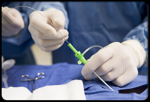 Dig?Dis?Sci：胰腺囊腫患者發生胰腺癌和胰腺癌相關死亡率較低