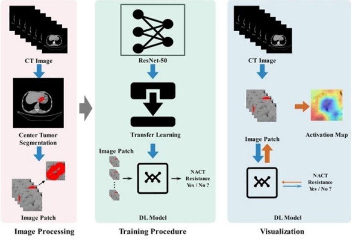 Gastric Cancer：深度學(xué)習(xí)模型預(yù)測進(jìn)展期胃癌新輔助化療療效